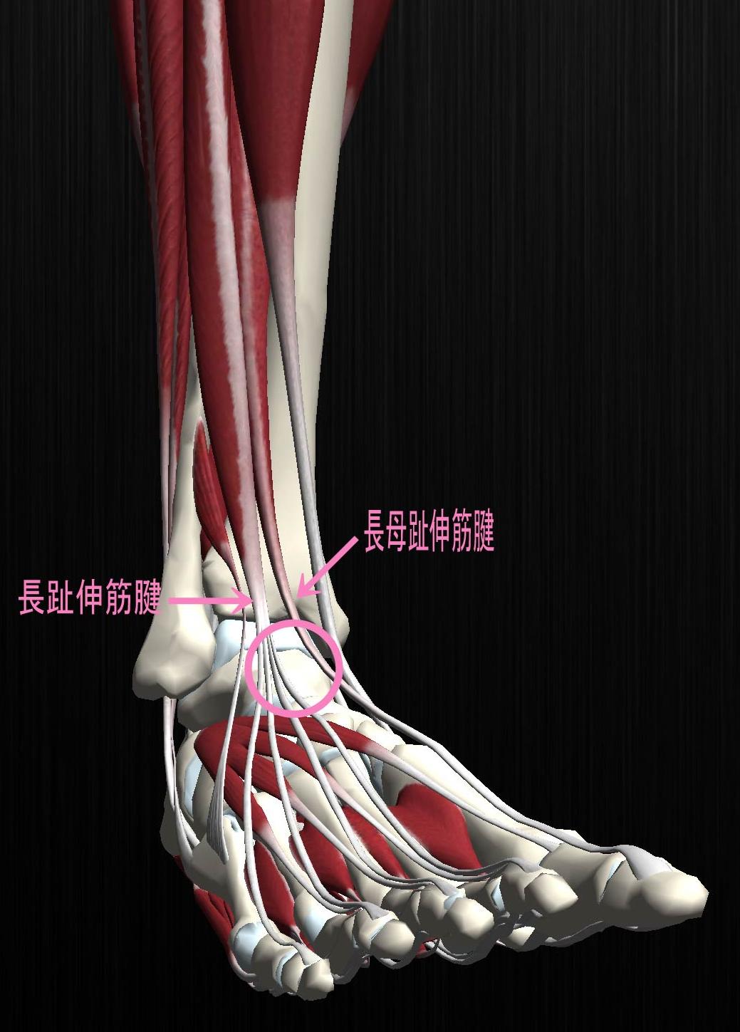 足 の 甲 腱鞘炎